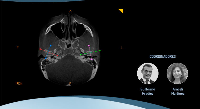  Simposio Internacional de Diagnóstico por la Imagen en Odontología COEM-SEPES