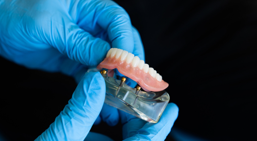 La ausencia de declaración de conformidad emitida por un protésico dental colegiado puede generar graves responsabilidades al odontólogo